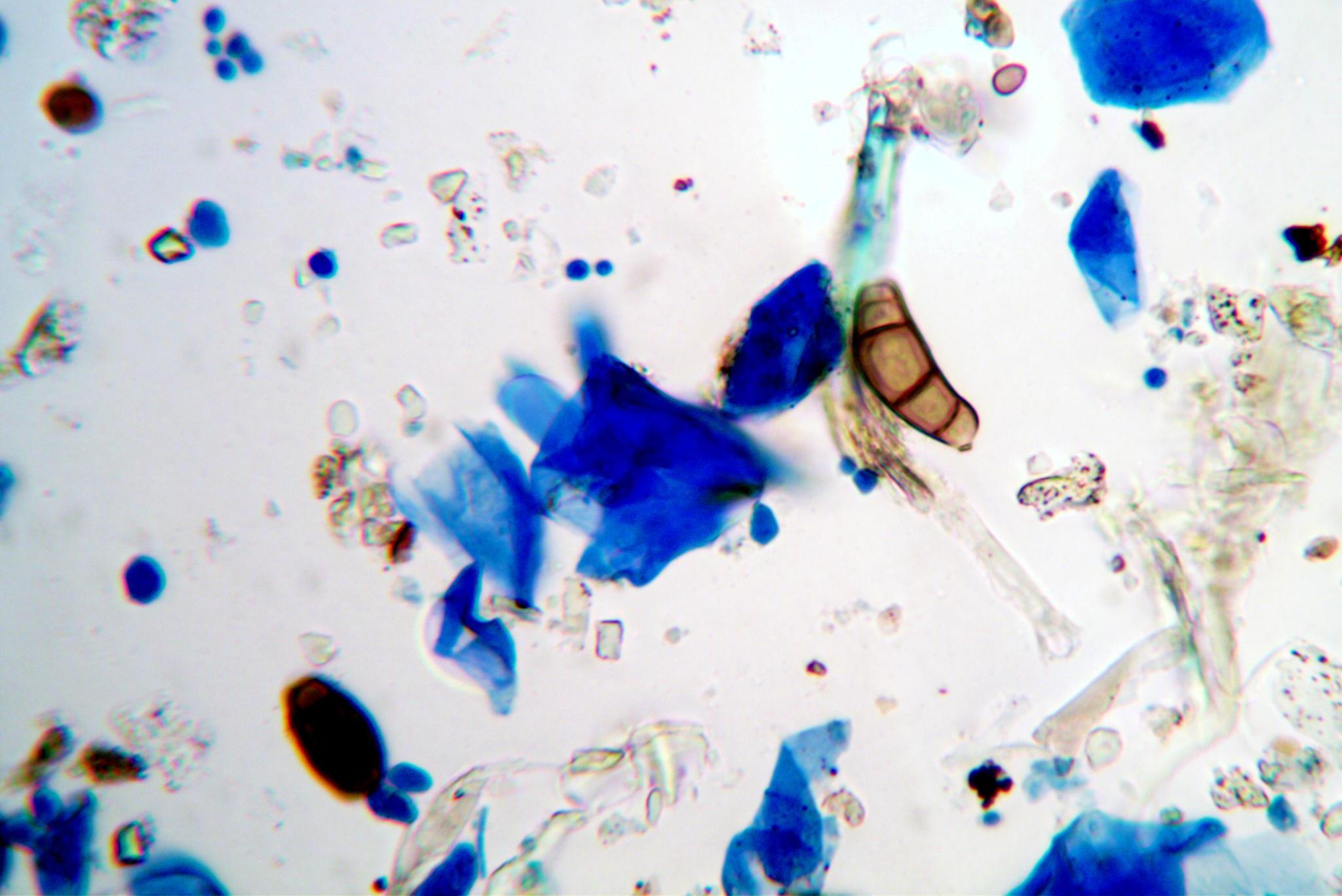 Direct Mold Growth Assessment Using TapeLift Technique LCS